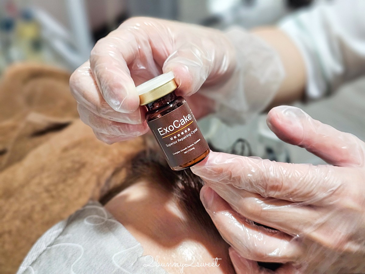 產後掉髮12年怎麼辦？40歲髮量稀疏開始在【絲若雲】進行「SS專利泌髮課程」紀錄 @兔兒毛毛姊妹花